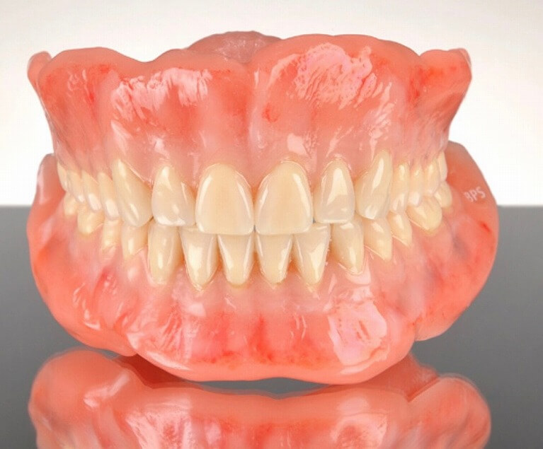 通常の入れ歯とBPSエステティックデンチャーの比較