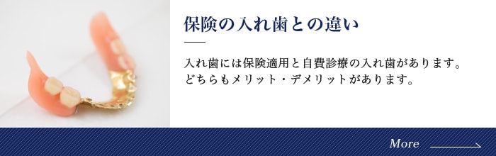 保険の入れ歯との違い